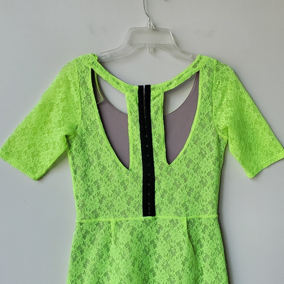 Silence + Noise Neon Lace Dress - Picture 13 of 15